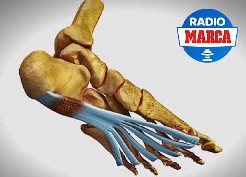 Fascitis plantar: causas, síntomas y tratamientos para deportistas activos